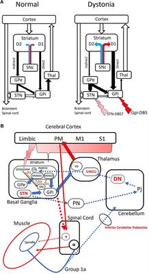 Direct cerebello-striatal loop in dystonia as a possible new target for deep brain stimulation: A revised view of subcortical pathways involved